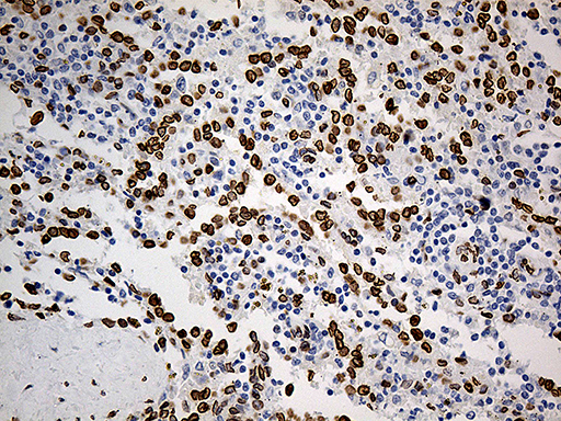 m07557 anti slu7 mouse monoclonal antibody clone id oti5a7 ihc testing 10