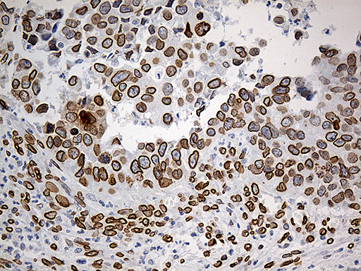 m07557 anti slu7 mouse monoclonal antibody clone id oti5a7 ihc testing 12