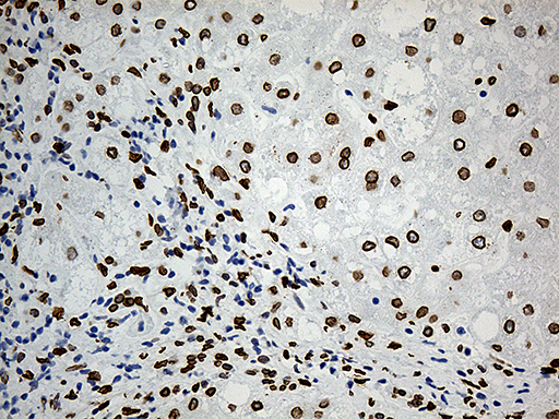m07557 anti slu7 mouse monoclonal antibody clone id oti5a7 ihc testing 14