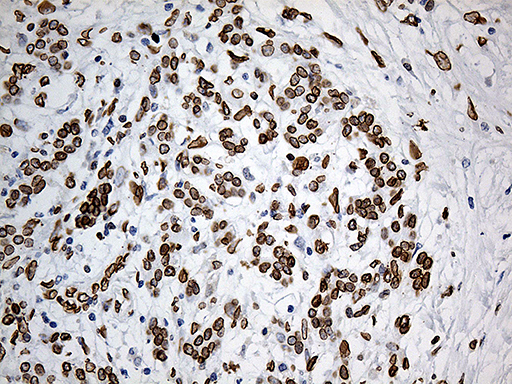 m07557 anti slu7 mouse monoclonal antibody clone id oti5a7 ihc testing 4