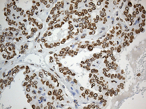 m07557 anti slu7 mouse monoclonal antibody clone id oti5a7 ihc testing 5