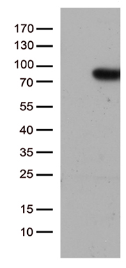 HEK293T cells were transfected with the pCMV6-ENTRY control (Left lane) or pCMV6-ENTRY SLU7 (Right lane) cDNA for 48 hrs and lysed