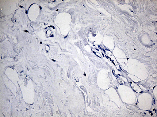 m07559 anti acaa1 mouse monoclonal antibody clone id oti4f1 ihc testing 2