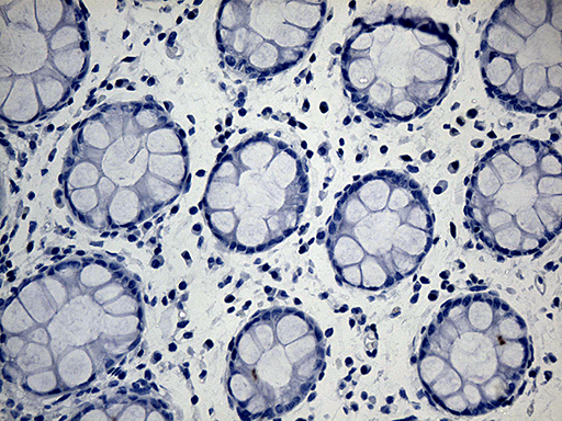 m07559 anti acaa1 mouse monoclonal antibody clone id oti4f1 ihc testing 3