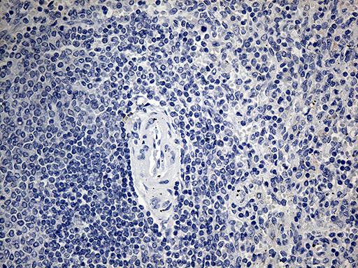 m07559 anti acaa1 mouse monoclonal antibody clone id oti4f1 ihc testing 4