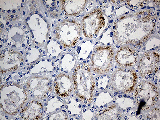 m07559 anti acaa1 mouse monoclonal antibody clone id oti4f1 ihc testing 5