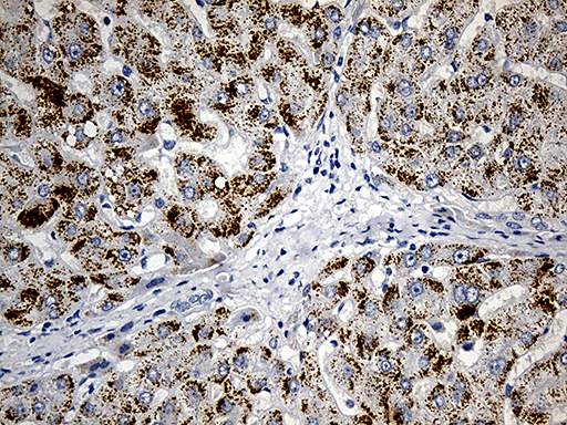 m07559 anti acaa1 mouse monoclonal antibody clone id oti4f1 ihc testing 6