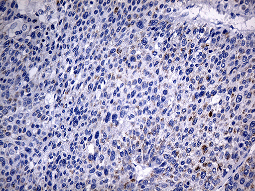m07559 anti acaa1 mouse monoclonal antibody clone id oti4f1 ihc testing 7