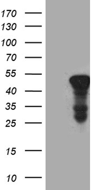 m07559 anti acaa1 mouse monoclonal antibody clone id oti4f1 wb testing 1