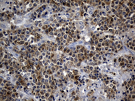 m07564 anti smap2 mouse monoclonal antibody clone id oti9b6 ihc testing 3