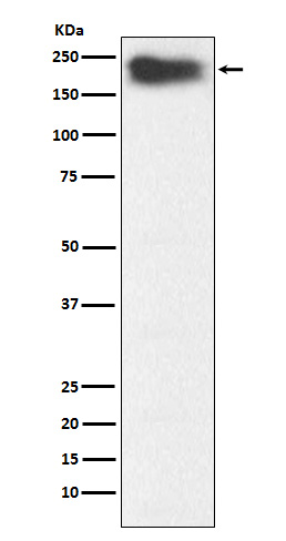 Western blot analysis of MYH7B expression in Human fetal muscle lysate