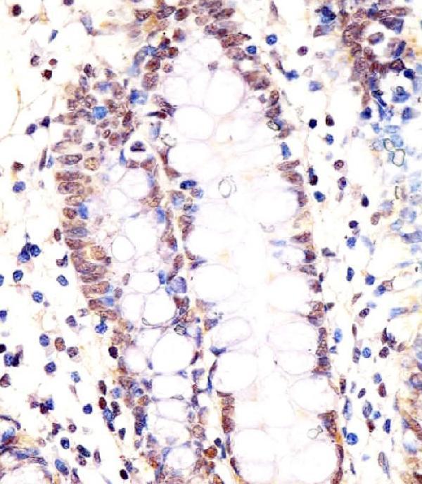 m07586 anti lsm2 antibody c term ihc p testing 2