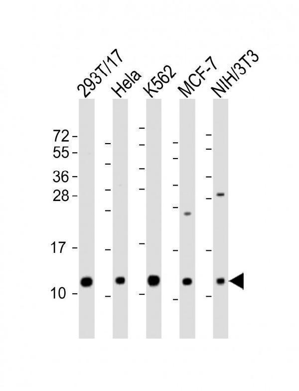 m07586 anti lsm2 antibody c term wb testing 1