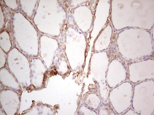 Immunohistochemical staining of paraffin-embedded Human thyroid tissue within the normal limits using anti-EFNA3 mouse monoclonal antibody