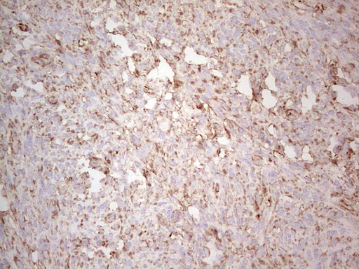 Immunohistochemical staining of paraffin-embedded Human endometrium tissue within the normal limits using anti-EFNA3 mouse monoclonal antibody