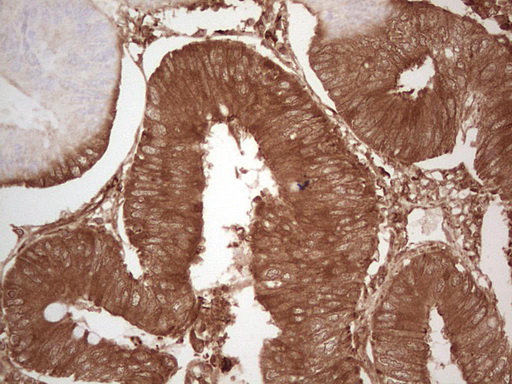 m07595 anti ephrin a3 efna3 mouse monoclonal antibody clone id oti4a4 ihc testing 4