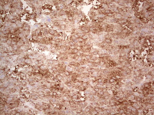 m07595 anti ephrin a3 efna3 mouse monoclonal antibody clone id oti4a4 ihc testing 6
