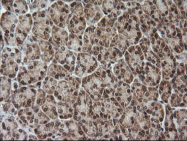 Immunohistochemical staining of paraffin-embedded Human pancreas tissue within the normal limits using anti-RTKN mouse monoclonal antibody