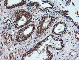m07596 1 anti rtkn mouse monoclonal antibody clone id oti2e9 ihc testing 4