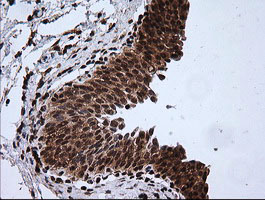 m07596 1 anti rtkn mouse monoclonal antibody clone id oti2e9 ihc testing 5