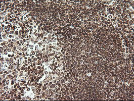 m07596 1 anti rtkn mouse monoclonal antibody clone id oti2e9 ihc testing 6