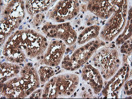 m07596 1 anti rtkn mouse monoclonal antibody clone id oti2e9 ihc testing 7