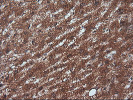 m07596 1 anti rtkn mouse monoclonal antibody clone id oti2e9 ihc testing 8