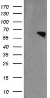 HEK293T cells were transfected with the pCMV6-ENTRY control (Left lane) or pCMV6-ENTRY RTKN (Right lane) cDNA for 48 hrs and lysed
