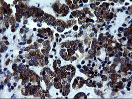 m07596 anti rtkn mouse monoclonal antibody clone id oti1a4 ihc testing 2