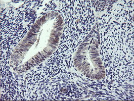m07596 anti rtkn mouse monoclonal antibody clone id oti1a4 ihc testing 3