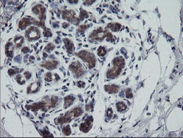 m07596 anti rtkn mouse monoclonal antibody clone id oti1a4 ihc testing 4