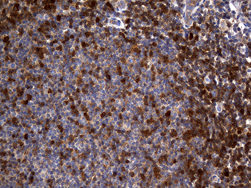 Immunohistochemical staining of paraffin-embedded Human tonsil within the normal limits using anti-GALM mouse monoclonal antibody