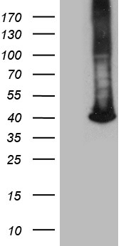 HEK293T cells were transfected with the pCMV6-ENTRY control (Left lane) or pCMV6-ENTRY GALM (Right lane) cDNA for 48 hrs and lysed