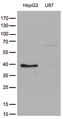 Western blot analysis of extracts (35ug) from cell lines and/or tissue lysates by using anti-GALM monoclonal antibody (1:500)