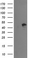 HEK293T cells were transfected with the pCMV6-ENTRY control (Left lane) or pCMV6-ENTRY PTPN7 (Right lane) cDNA for 48 hrs and lysed