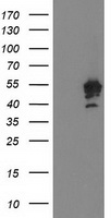 HEK293T cells were transfected with the pCMV6-ENTRY control (Left lane) or pCMV6-ENTRY PTPN7 (Right lane) cDNA for 48 hrs and lysed