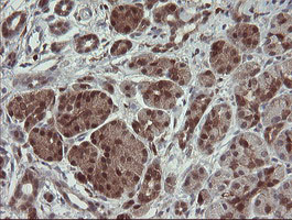 Immunohistochemical staining of paraffin-embedded Human pancreas tissue within the normal limits using anti-SDSL mouse monoclonal antibody