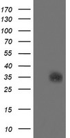 HEK293T cells were transfected with the pCMV6-ENTRY control (Left lane) or pCMV6-ENTRY SDSL (Right lane) cDNA for 48 hrs and lysed