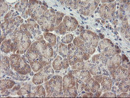 m07607 anti arl2bp mouse monoclonal antibody clone id oti1a10 ihc testing 2