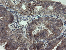 m07607 anti arl2bp mouse monoclonal antibody clone id oti1a10 ihc testing 4