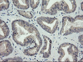 m07607 anti arl2bp mouse monoclonal antibody clone id oti1a10 ihc testing 5