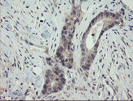 m07607 anti arl2bp mouse monoclonal antibody clone id oti1a10 ihc testing 6