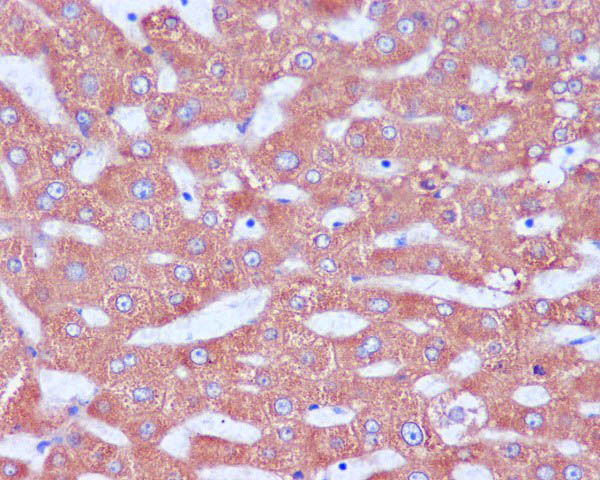 Immunohistochemical analysis of paraffin-embedded human liver, using KDEL Antibody.
