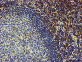 m07621 1 anti nmt2 mouse monoclonal antibody clone id oti2a5 ihc testing 4
