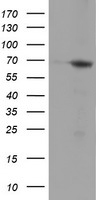 HEK293T cells were transfected with the pCMV6-ENTRY control (Left lane) or pCMV6-ENTRY NMT2 (Right lane) cDNA for 48 hrs and lysed
