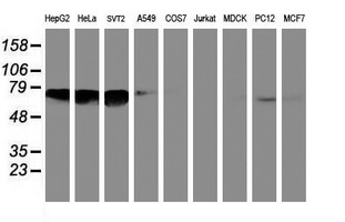 Western blot analysis of extracts (35ug) from 9 different cell lines by using anti-NMT2 monoclonal antibody