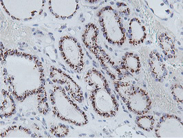 m07621 anti nmt2 mouse monoclonal antibody clone id oti1g3 ihc testing 4