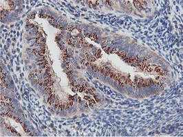 m07621 anti nmt2 mouse monoclonal antibody clone id oti1g3 ihc testing 5