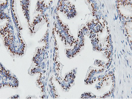 m07621 anti nmt2 mouse monoclonal antibody clone id oti1g3 ihc testing 6