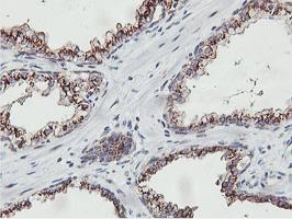 m07621 anti nmt2 mouse monoclonal antibody clone id oti1g3 ihc testing 7